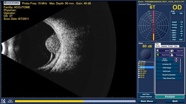 Accutome B-Scan Plus - Image 3