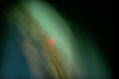 Ellex Tango YAG/SLT Laser - Image 3
